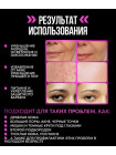 Микротоковый массажëр