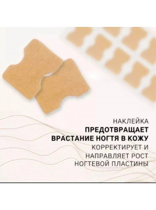 Наклейки против вросших ногтей 10 шт.